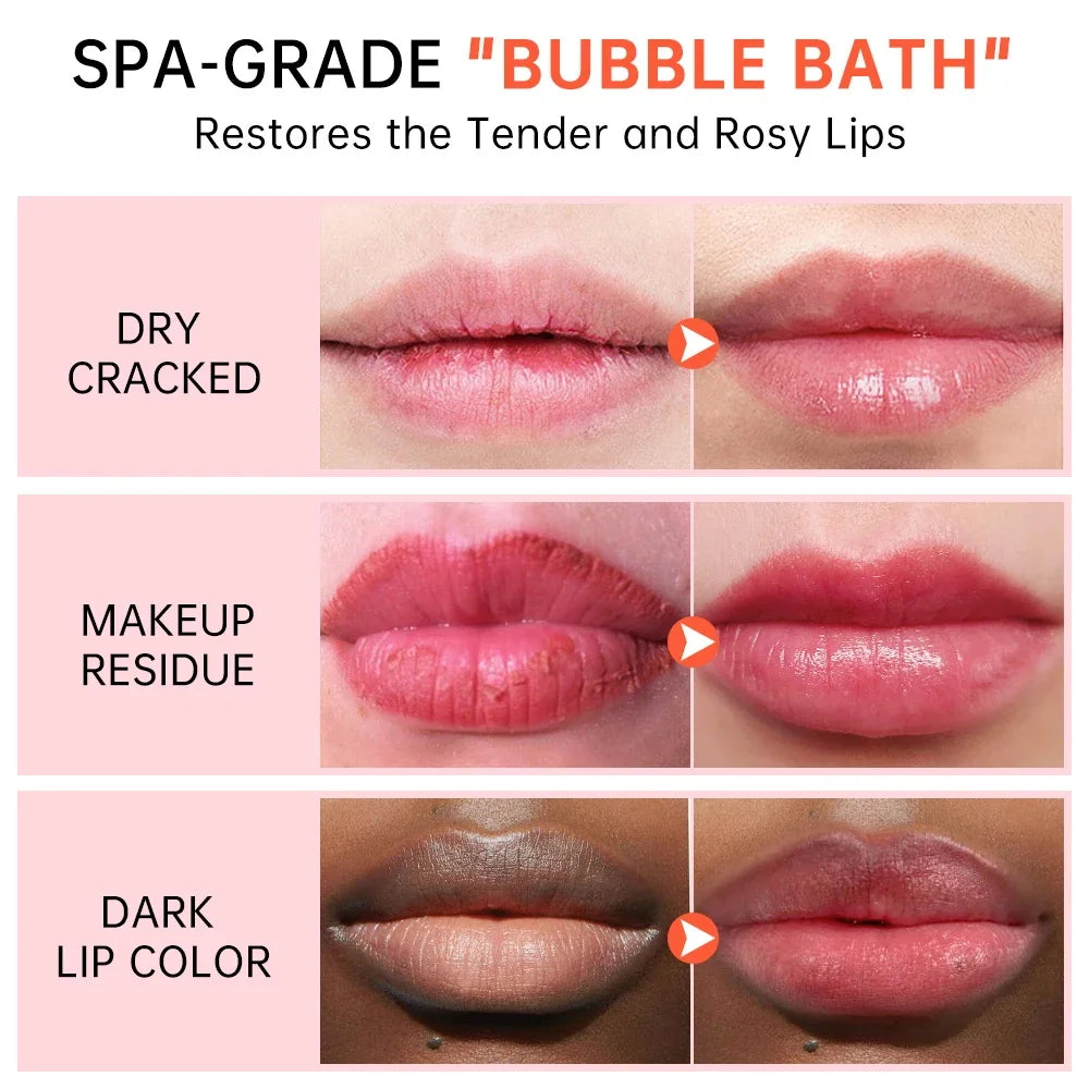 Remove Dark Smoke Lip Balm Lightening Melanin Bleaching Gloss Oil Lips Pink Lipstick Exfoliating Fade Lip Lines Korean Cosmetics Qme