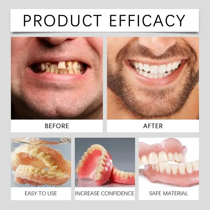 Denture Silicone Liners Soft Teeth Upper Lower Dentures Fake Tooth Qme