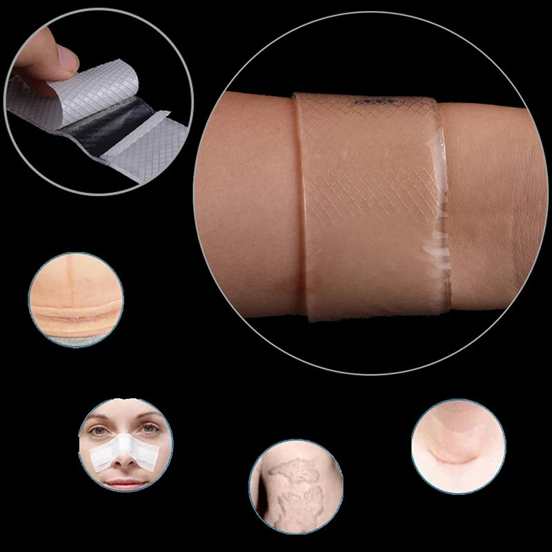 Scar Therapy Remove Trauma Burn Silicon Patch Reusable Acne Gel Skin Qme