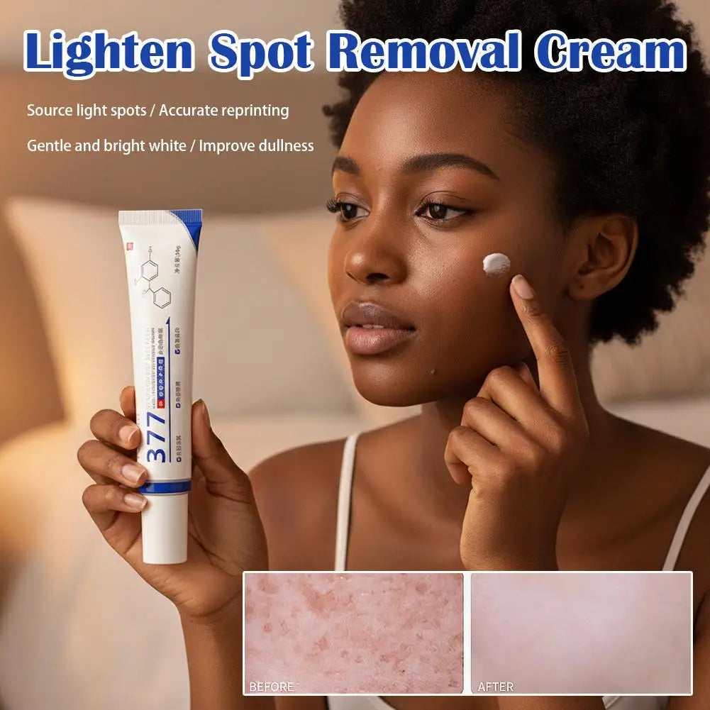 Facial Redness Repair Cream Improve Sensitive Skin Dryness Moisturizer Hydrating Sooth Lotion Lightening Spot Removal Cream Qme