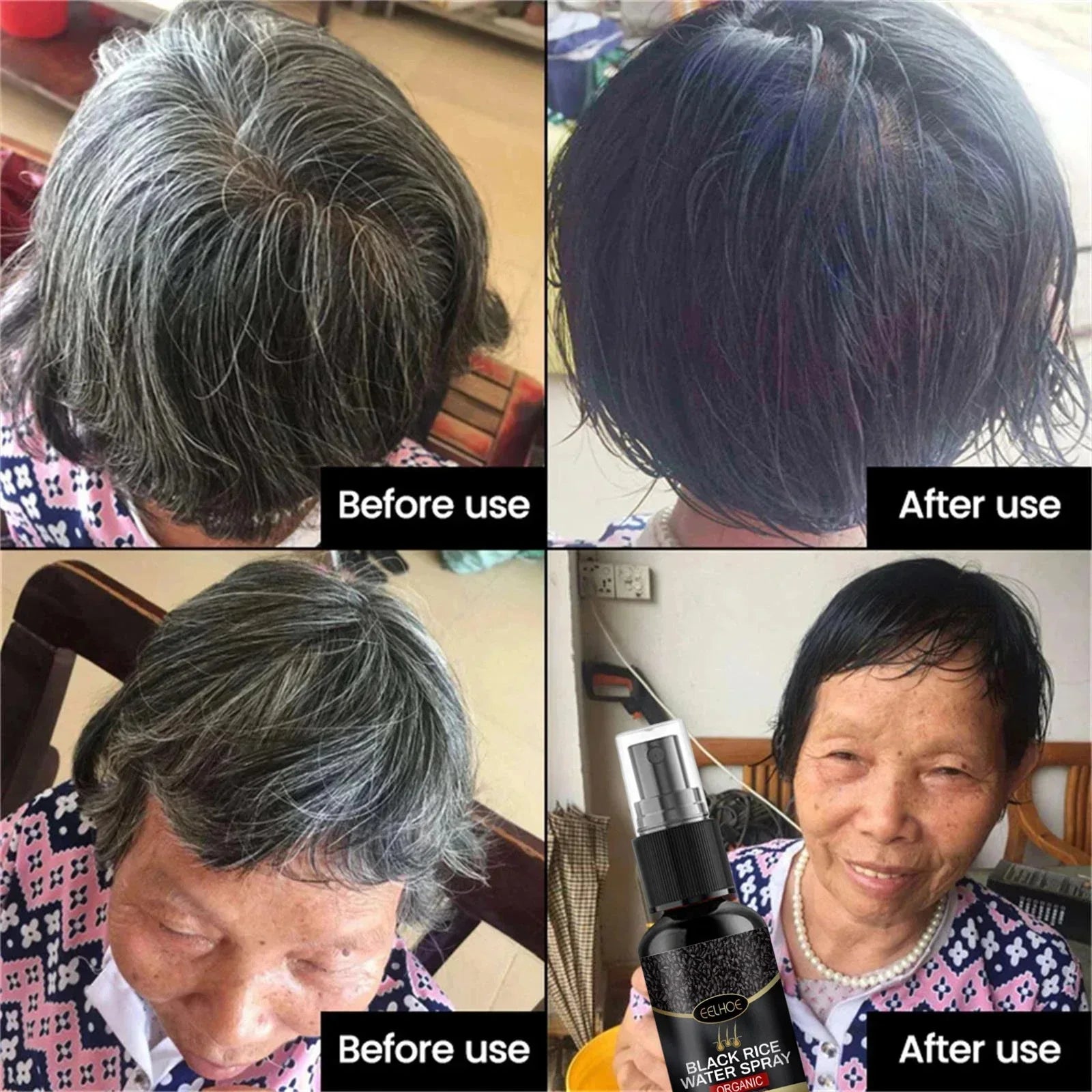 Gray White Hair Treatment Serum Cover White Hair To Black Natural Color Repair Spray Anti Loss Hair Restore Healthy Care Qme