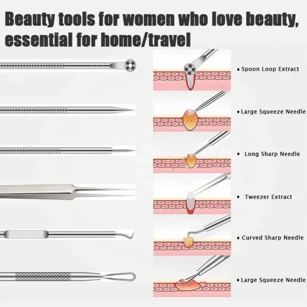 Stainless Steel Blackhead Remover Tools Comedone Extractor Tweezers Qme