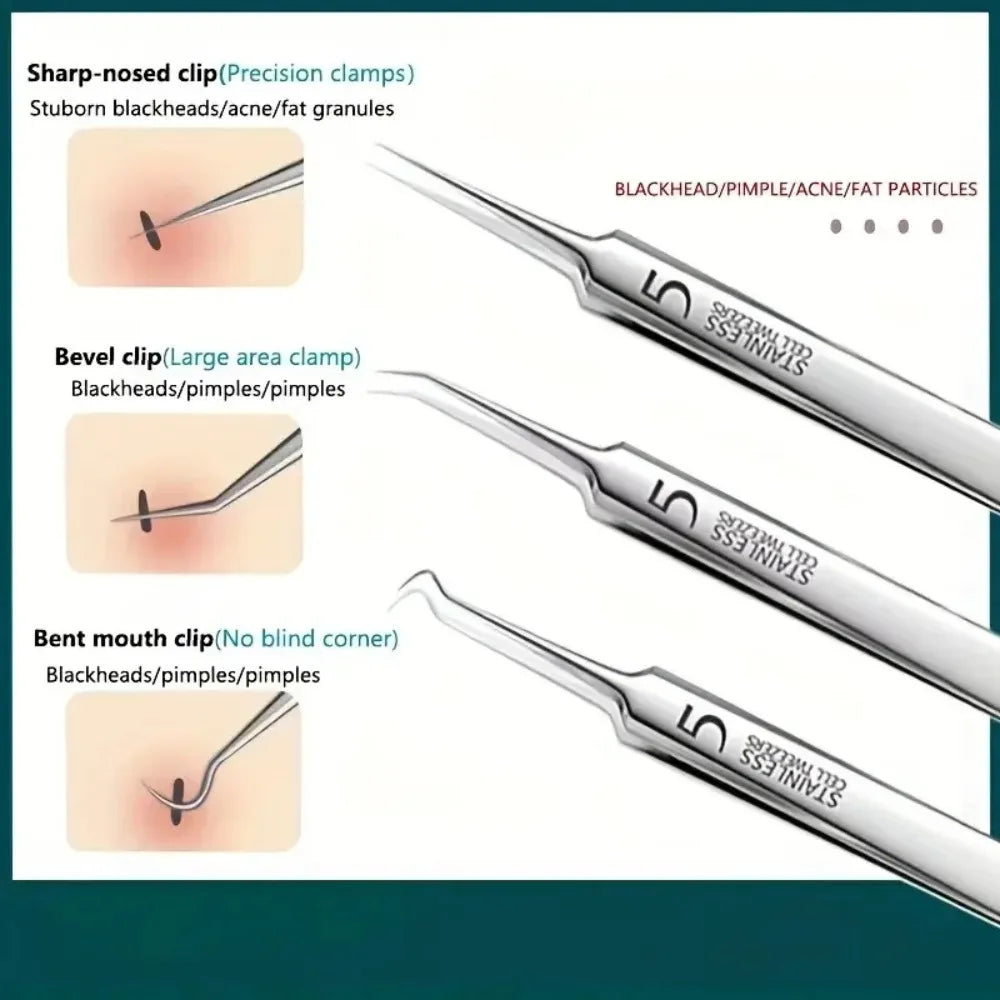 1- Stainless Steel Acne Clip Cell Blackhead Needle Beauty Salon Tool Qme