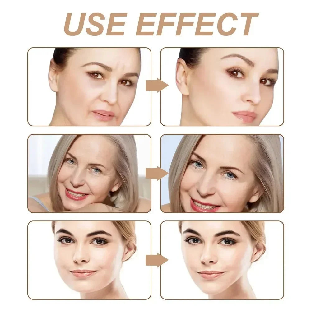 Kinesiology Tape Face V Line Neck Eyes Lifting Wrinkle Remover Qme