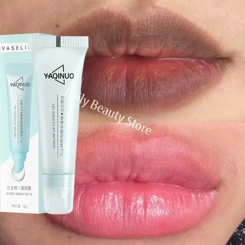 Remove Dark Lip Balm Fast Lightening Pink Lip Exfoliating Fade Lip Line Dead Skin Moisturizer Korean Care Products Beauty Health Qme