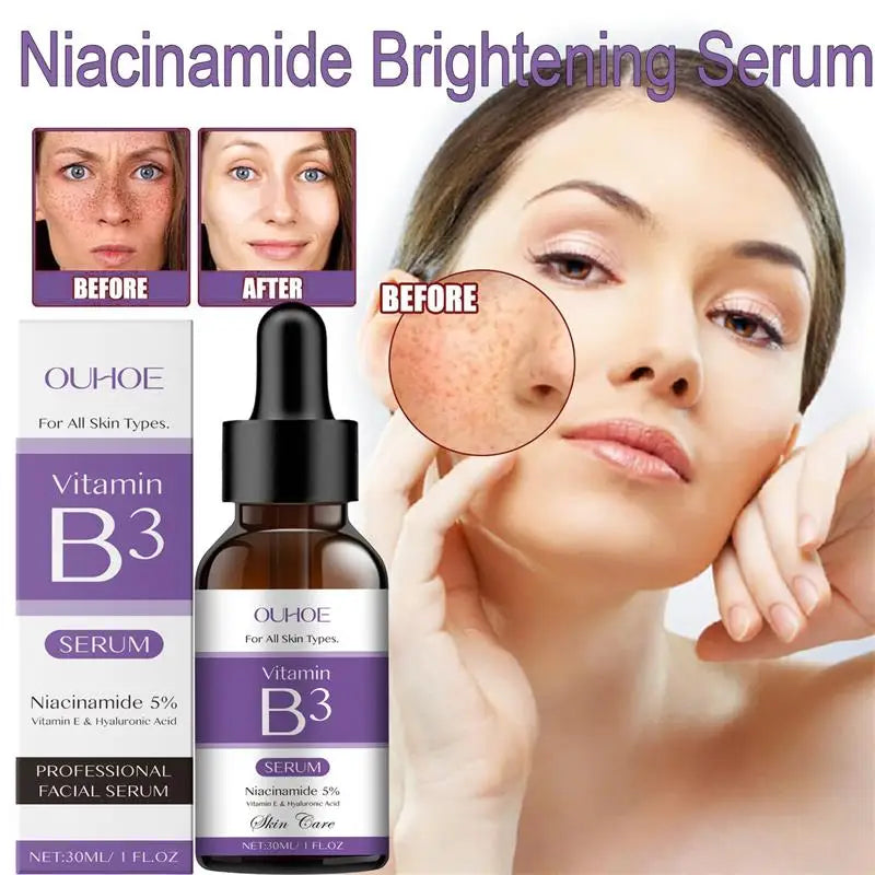 Niacinamide Facial Serum Vitamin B3 Wrinkles Pigment Dark Spot Removal Correcting Glow Serum Face Whitening Moisturizer Serum Qme