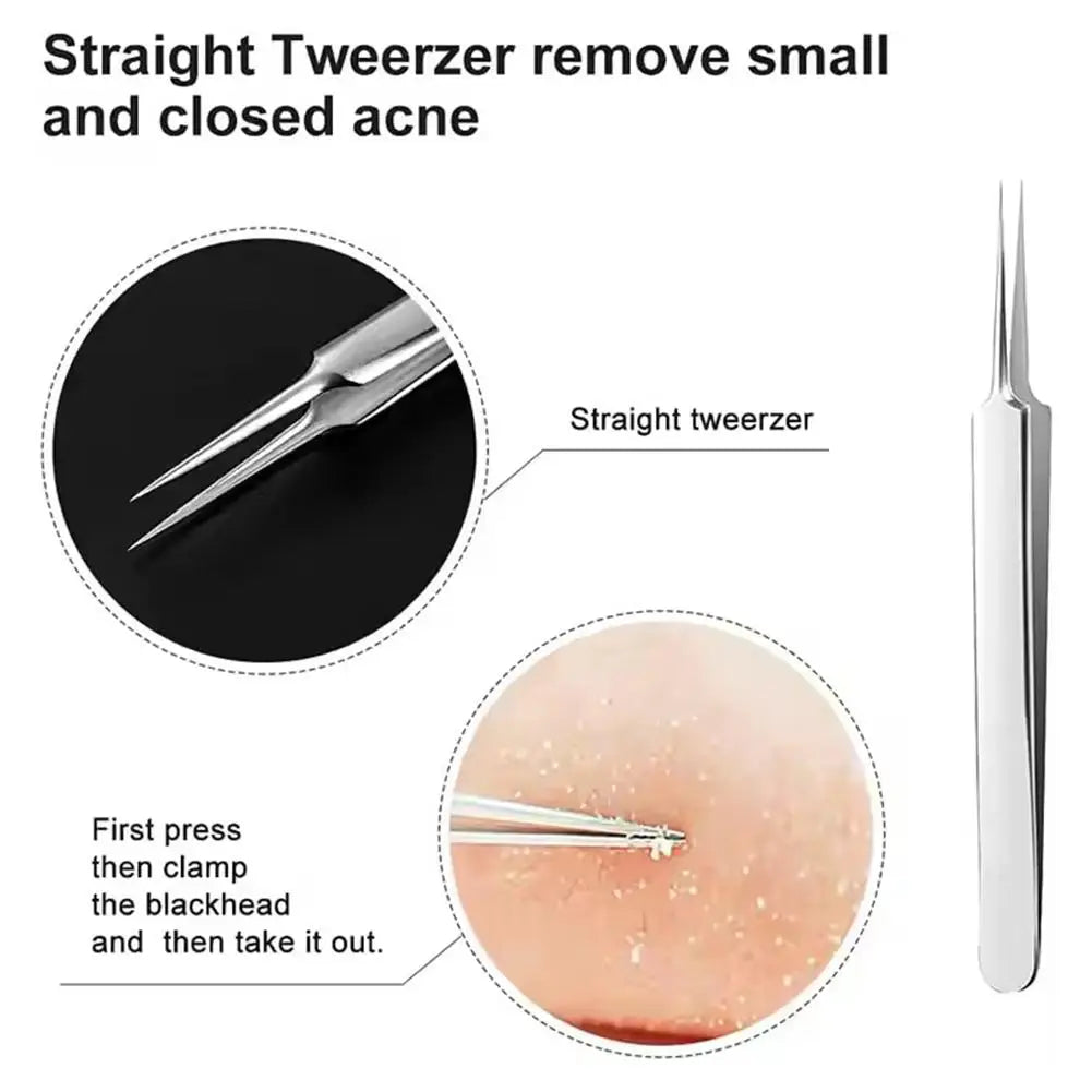 Acne Needle Blackhead Clip Remover Extraction Pore Black Head Clean Qme