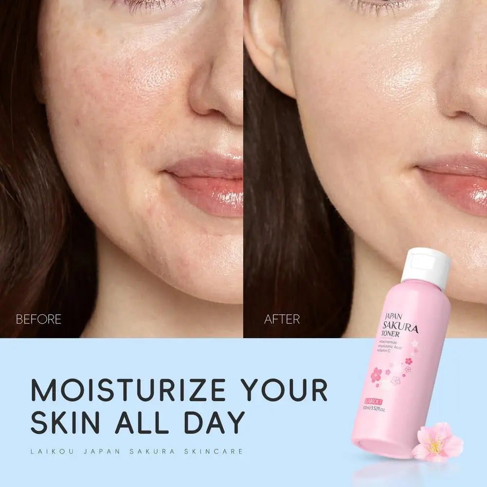 Sakura Face Lotion Moisturizing Essence Hydrating Oil Control Skin Qme