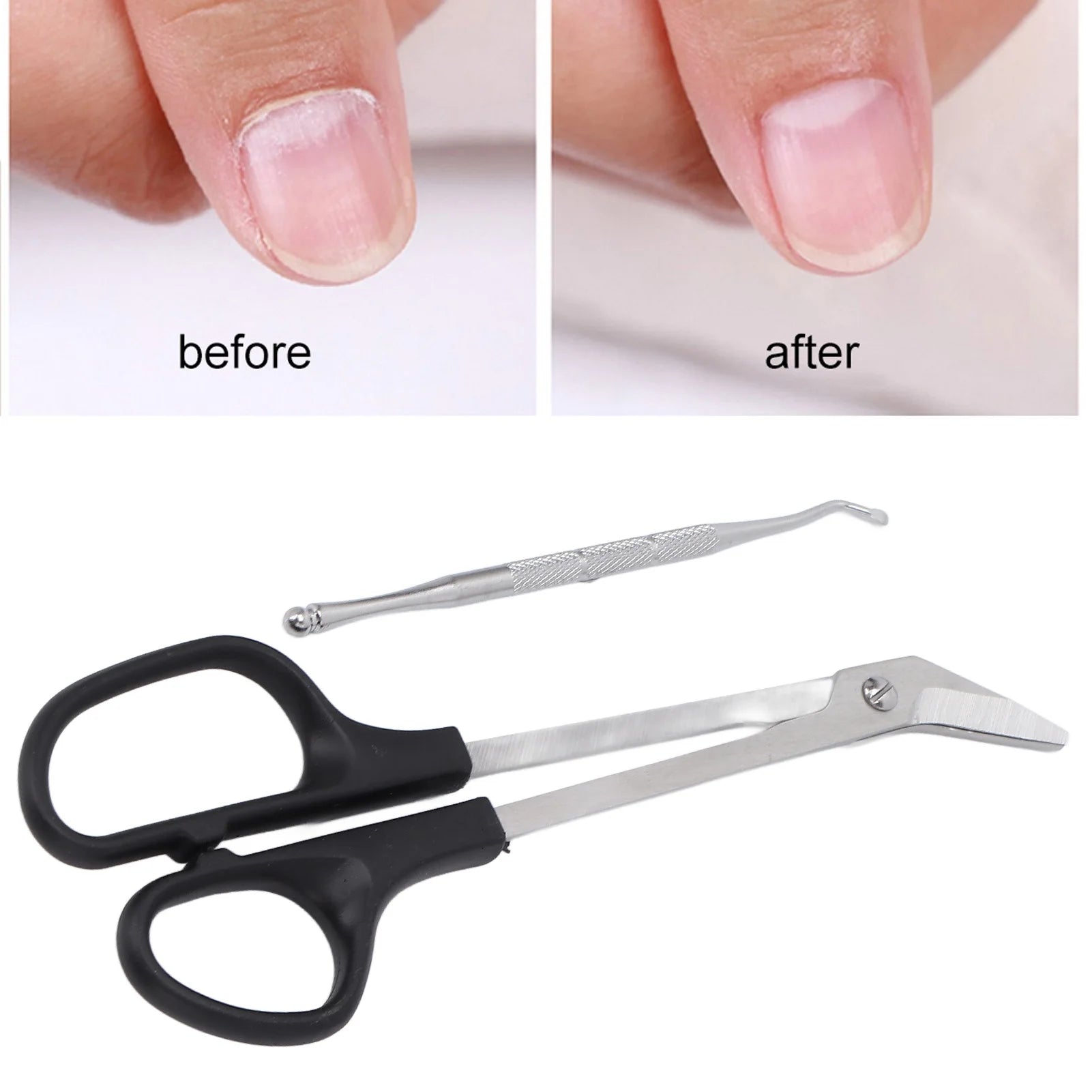 Toenail Clippers Toenail Scissors Long Handled Ergonomic Unique Design Toenail Clippers with Nail Picker for Adults The Elderly Qme