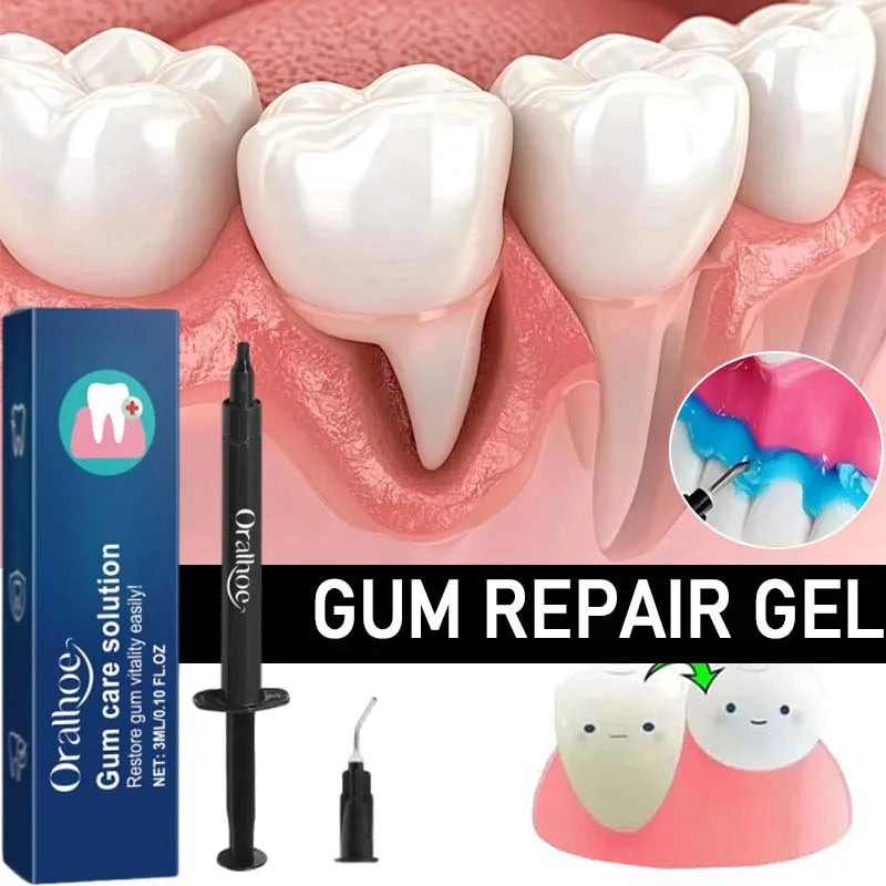 Gum Repair Care Gel Relieve Sore Gum Improve Gingival Damaged Inflammation Cleaning Teeth Stains Tartar Whitener Gum Protect Gel Qme