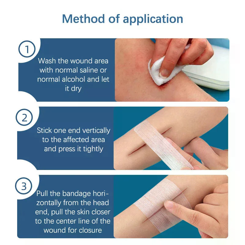 2 3 5 Strip Wound Closure Tape Adhesive Sterile Medical Bandage Skin Qme
