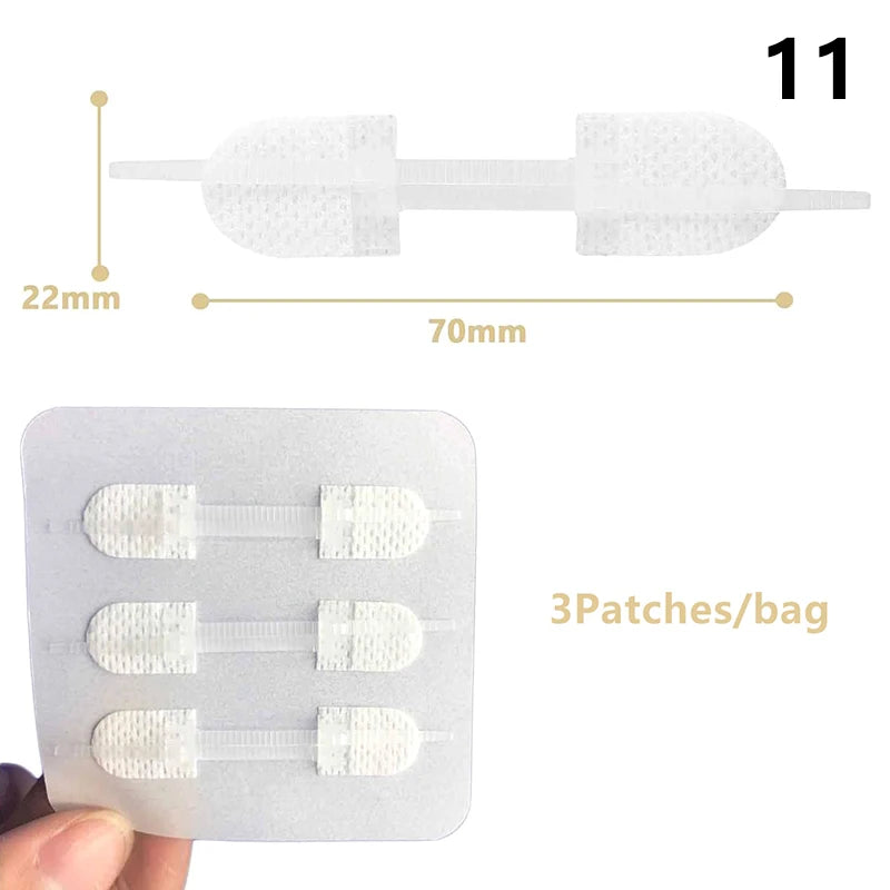 1 3 10 50 Patches Butterfly Closure Bandage Strips Adhesive Strip Qme 11 3Patches