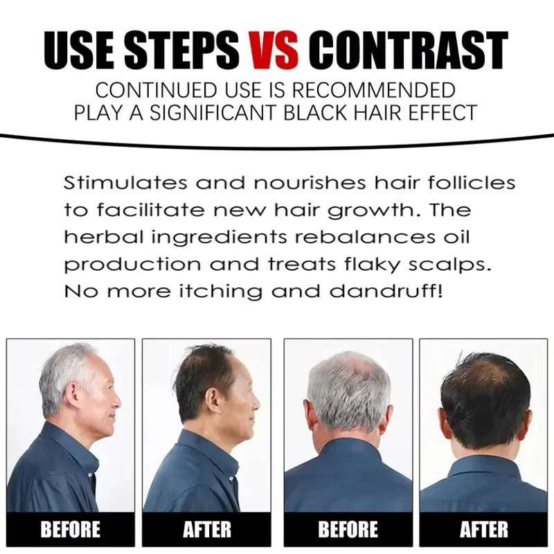 Herbal Anti-grey Treatment Hair Dye Shampoo White To Black Permanent Repair Natural Color Nourish Scalp Hair Care Products Qme