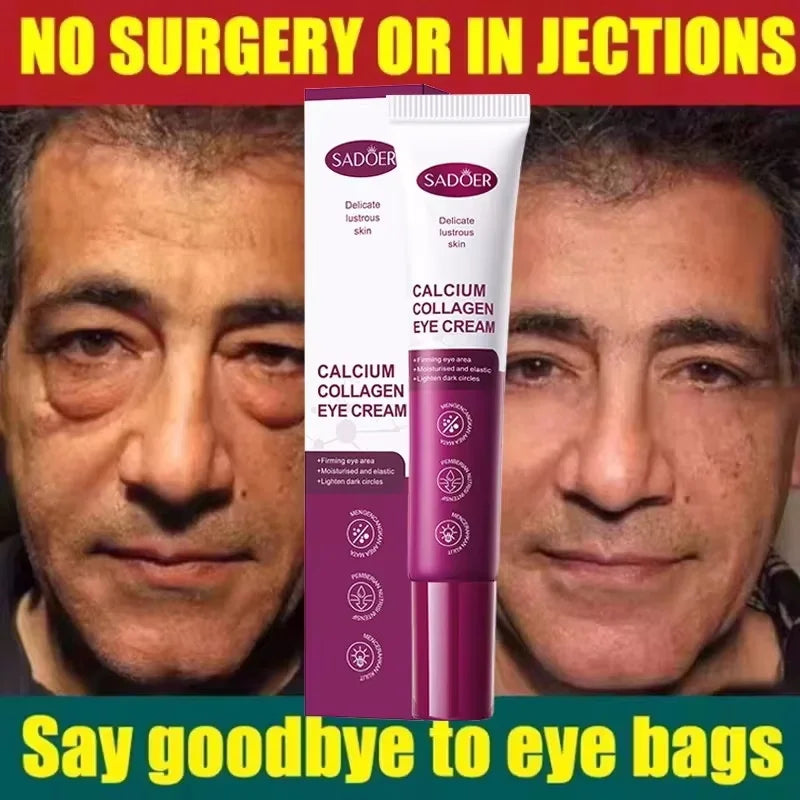 Instant Eye Bag Remove Eye Cream Anti Fat Particles Dark Circles Puffiness Fade Fine Lines Lift Brighten Korean Beauty Eye Care Qme