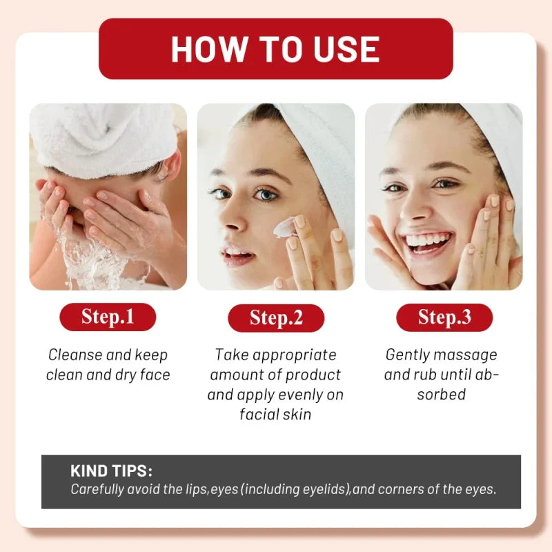 Powerful Spot-Removing Whiten Cream Brighten Skin Fast Eliminates Melanin Pigmentation Melasma Dark Spots Korean Face Skin Care Qme