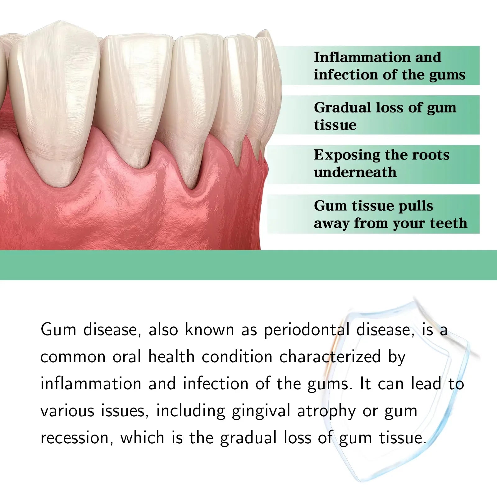 Gum Repair Drops Relieve Receding Gingival Swelling Gum Cleaning Care Oral Periodontal Hygiene Remove Yellow Remove Stain Qme