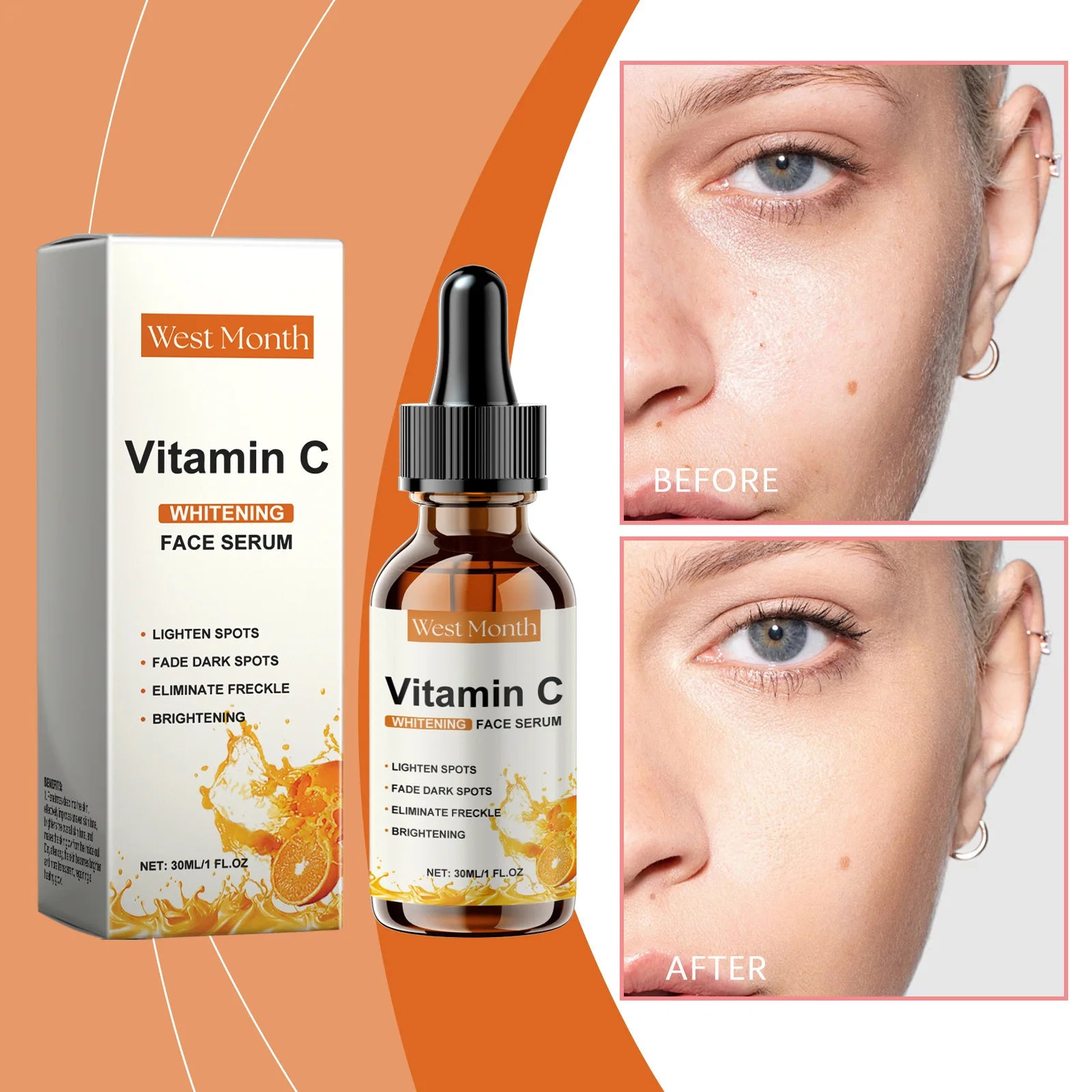 Vitamin C Whitening Serum Remove Freckles Dark Spots Face Essence Fade Melasma Melanin Brighten Repair Dull Skin Care Cosmetics Qme