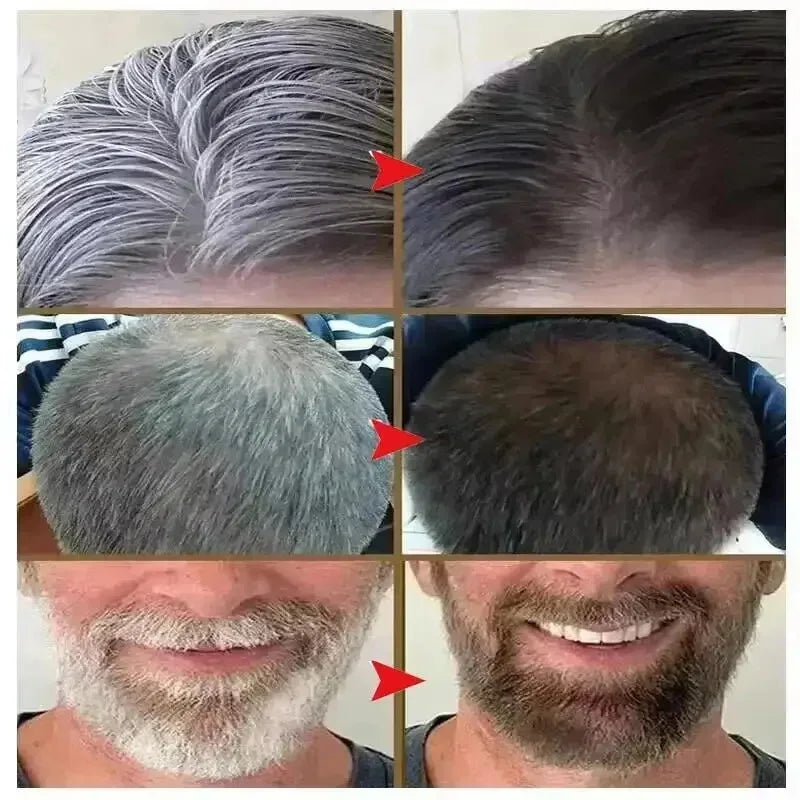 Plant Bubble Hair Dye Shampoo No Irritation Natural Hair Dye Gray White To Black Long Lasting Coloring Fashion Style Hair Care Qme