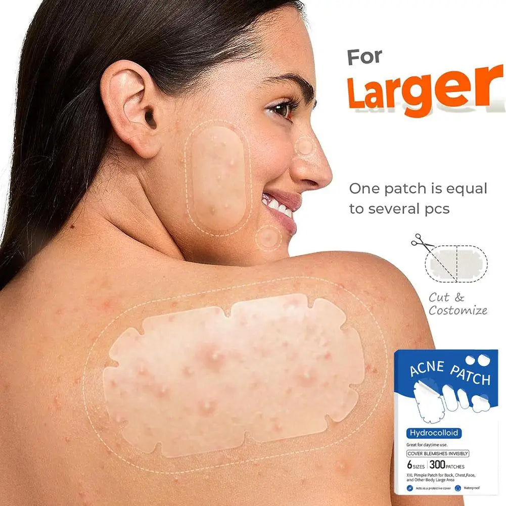 1/10/300pcs Special shaped acne patch Invisible Pimple Cover For Face Oil Control Spot Treatment Sticker Acne Tool Qme