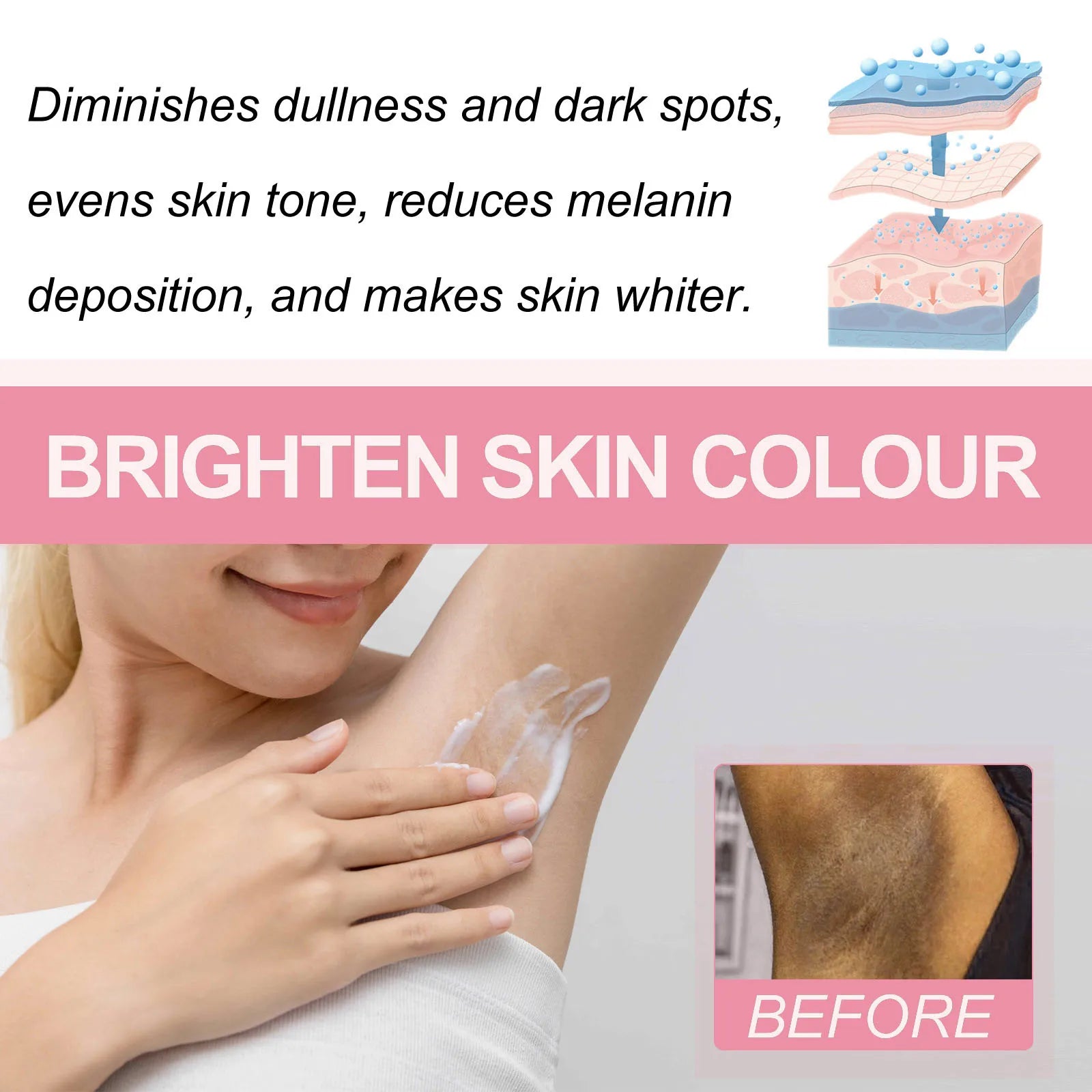 Skin Whitening Serum Private Parts Underarm Bleaching Serum Whiten Butt Knee Brighten Inner Thigh Arm Body Remove Dark Melanin Qme