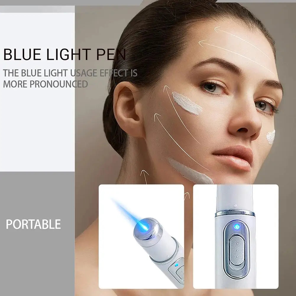 Under-eye Blue Light Therapy Pen Face LED Massage Beauty Device Heat Qme
