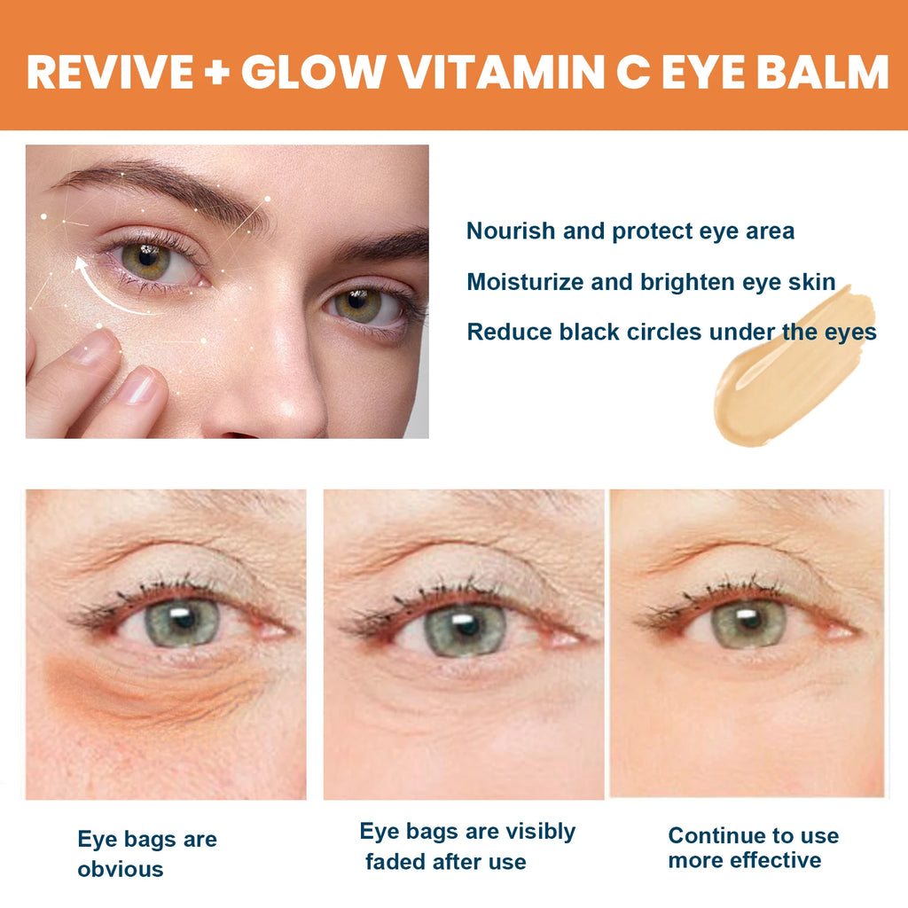 Vitamin C Eye Balm Moisturizing Eye Bag Removal Dark Circles Reduce Fine Lines Anti Puffiness Brightening Eye Cream Stick Qme