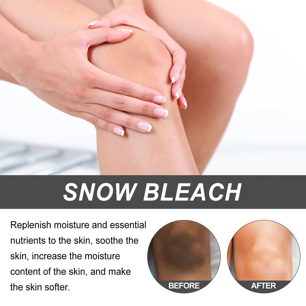 Whitening Cream Private Parts Underarm Bleaching Serum Whiten Butt Knee Brighten Inner Thigh Intimate Parts Dark Remove Melanin Qme