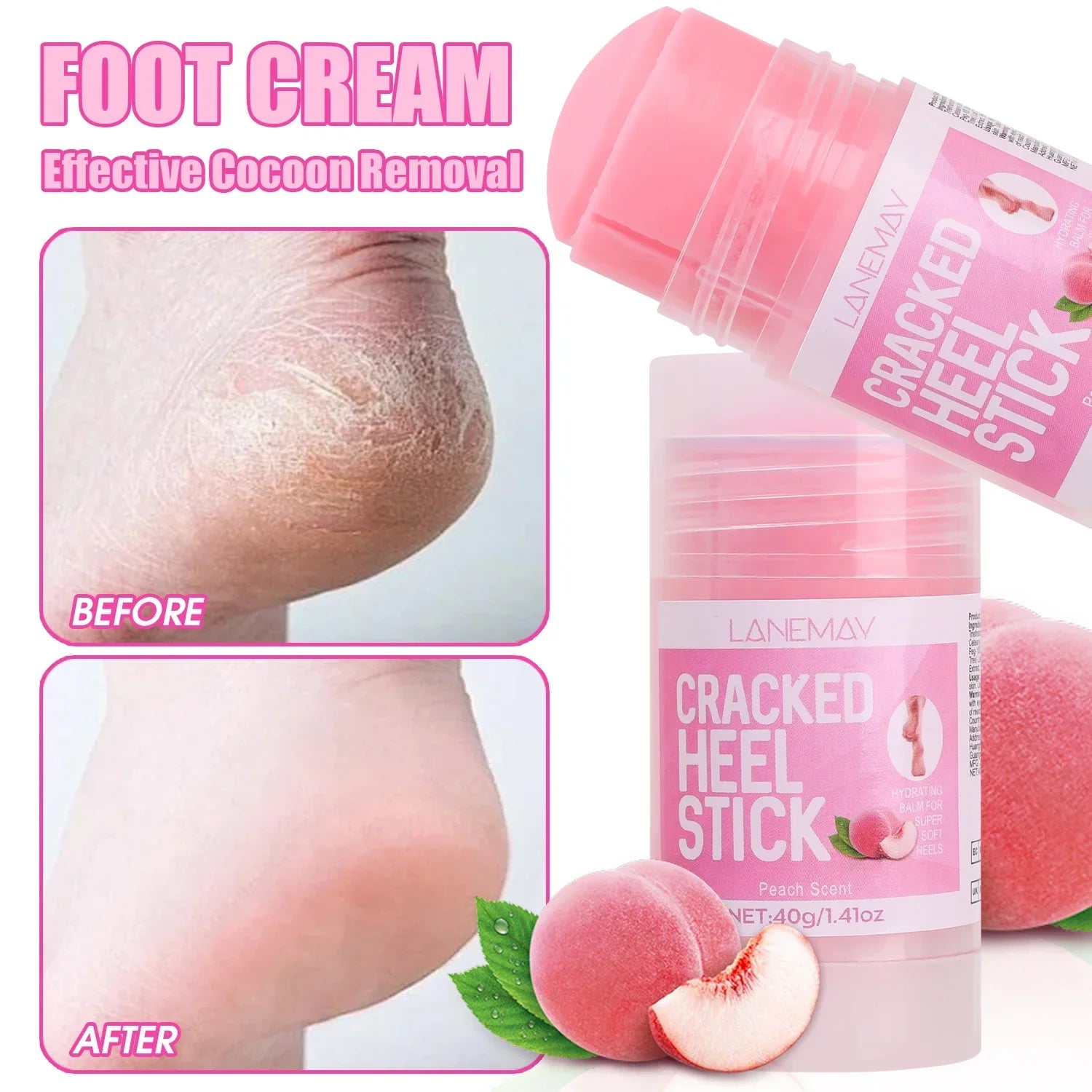 Ultra-Hydrating Foot Care Cream Anti-Drying Crack Removal Dead Moisturizing Skin Hand Feet Care Softening Calluses Cracked Cream Qme