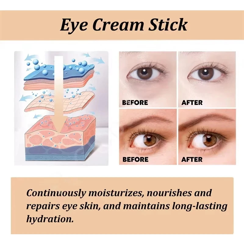 Instant Eye Bag Removal Rolling Beads Massage Serum Retinol Anti-Wrinkle Firm Skin Anti Dark Circle Puffiness Brighten Eye Care Qme