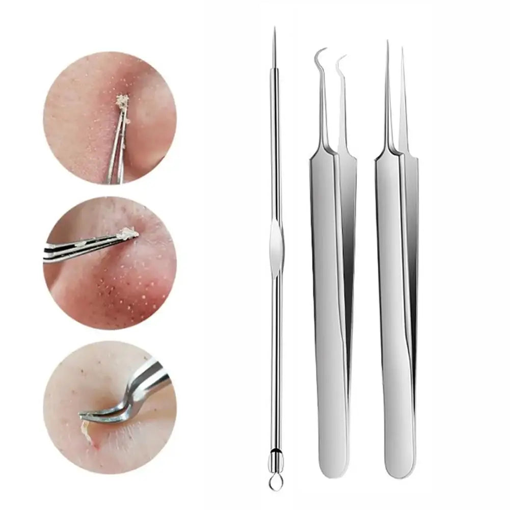 Acne Needle Blackhead Clip Remover Extraction Pore Black Head Clean Qme