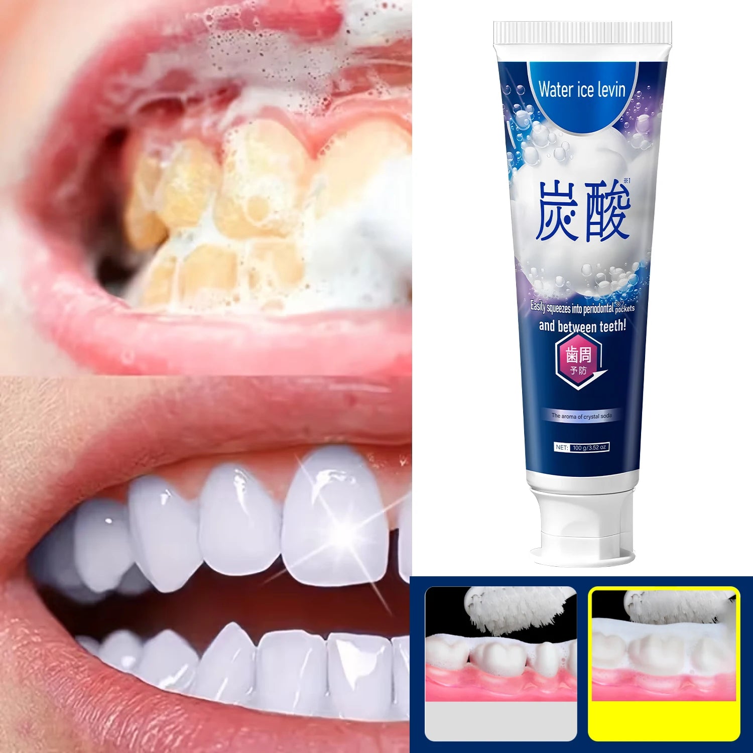 Remineralizing Hydroxyapatite Toothpaste with Vitamin C & Ceramide, Deep Clean Periodontal Pockets, Moisturizing Mint Flavor Qme