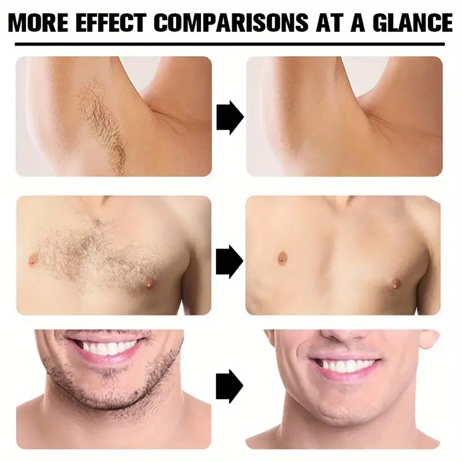 Hair Removal Cream Permanent Epilator Cream Intimate Areas Health Painless Hair Remover Growth Inhibitor for Woman Men Body Care Qme