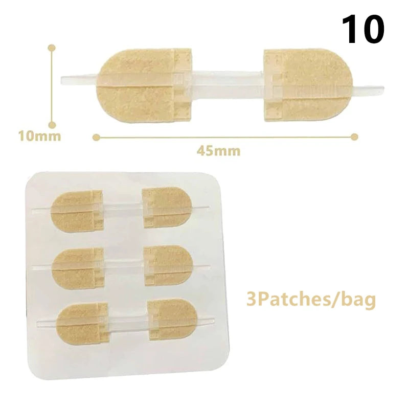 1 3 10 50 Patches Butterfly Closure Bandage Strips Adhesive Strip Qme 10 3Patches