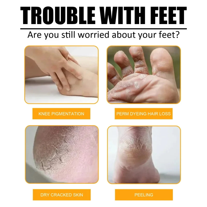 Foot Cuticle Remove Dead Foot Exfoliator Softener Remove Dead Skin and Calluses Foot Mask Pedicure Nail Enhancer Qme
