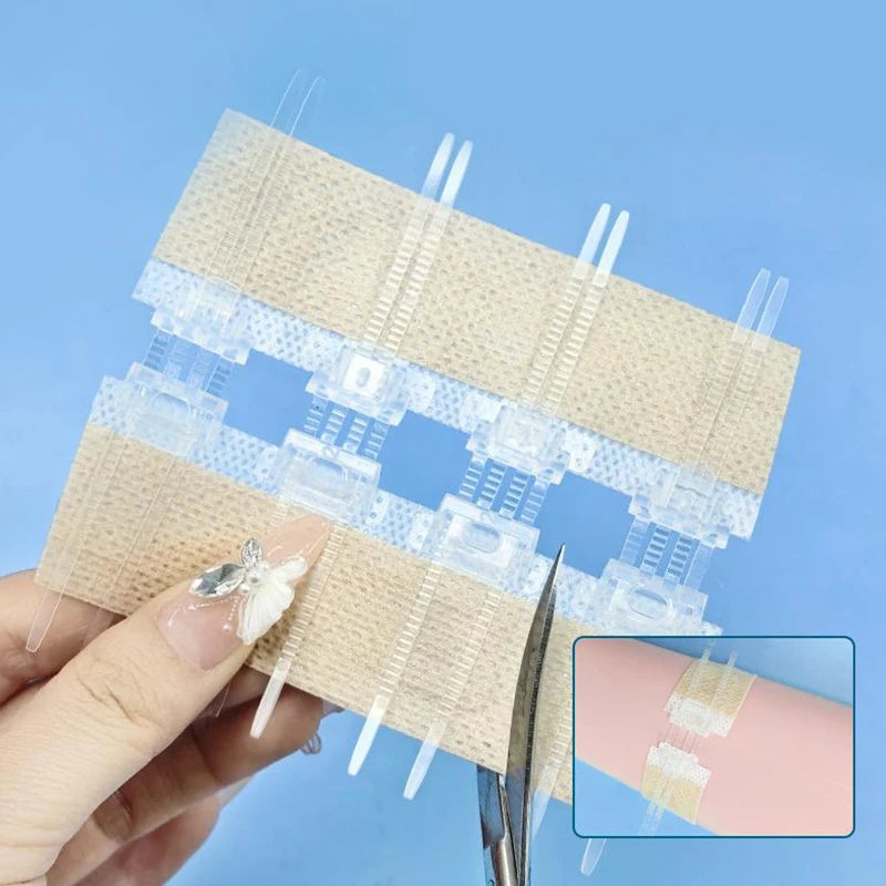 Zipper Tie Wound Closure Patch Hemostatic Fast Without Suture Outdoor Qme