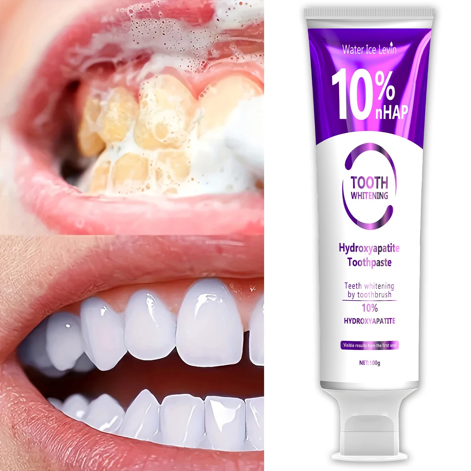 Oxide Tooth Whitening Hydroxyapatite Toothpaste Toothbrush for Whitening Teeth 10% Hydroxyapatite Visible Results with First Use Qme