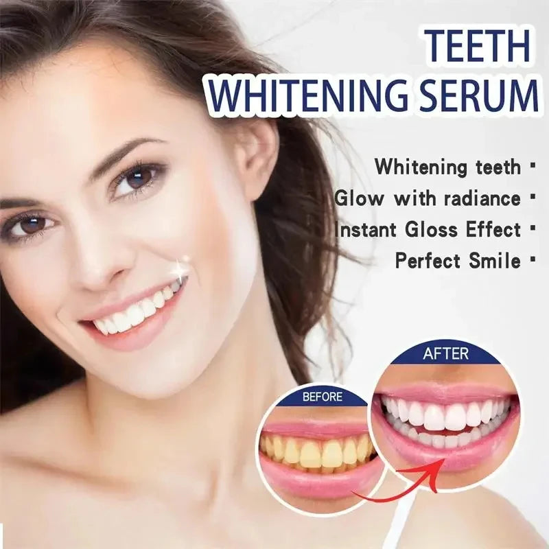 Tooth Whitening Essence Tooth Calculus Removing Dental Plaque Bad Breath Yellow Teeth Repairing Gums Teeth Cleaning Toothpaste Qme