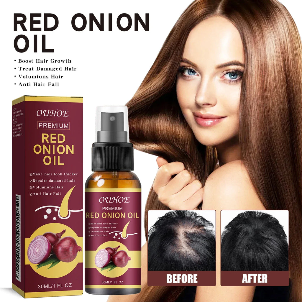 Red Onion Hair Growth Essential Oil Care Spray Prevent Hair Loss Nourish Roots Improve Hair Texture Care Products Qme