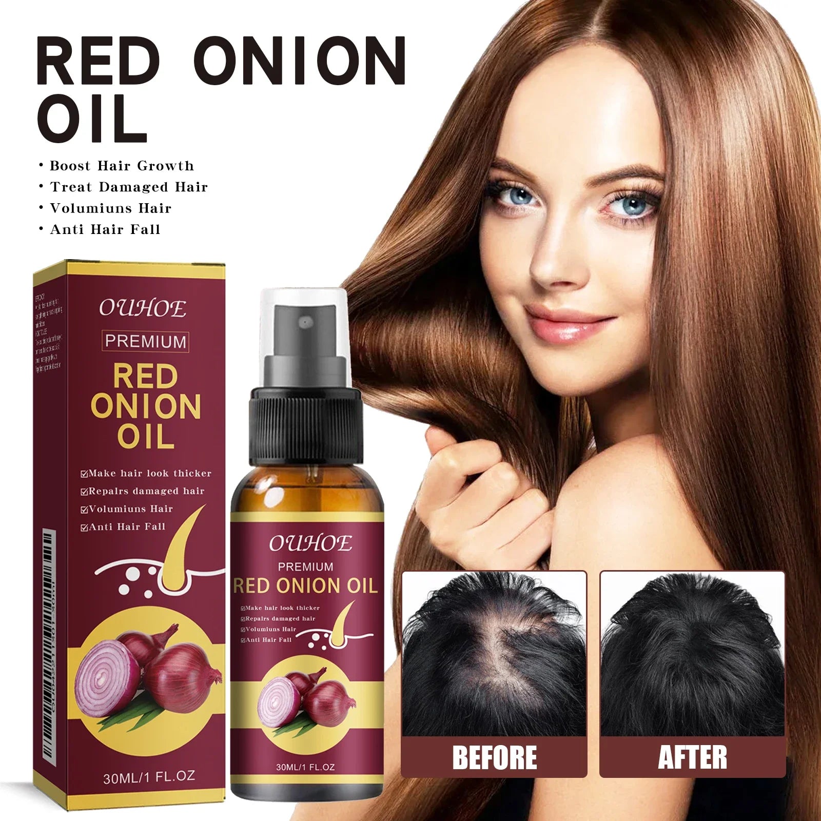 Red Onion Hair Growth Essential Oil Care Spray Prevent Hair Loss Nourish Roots Improve Hair Texture Care Products Qme