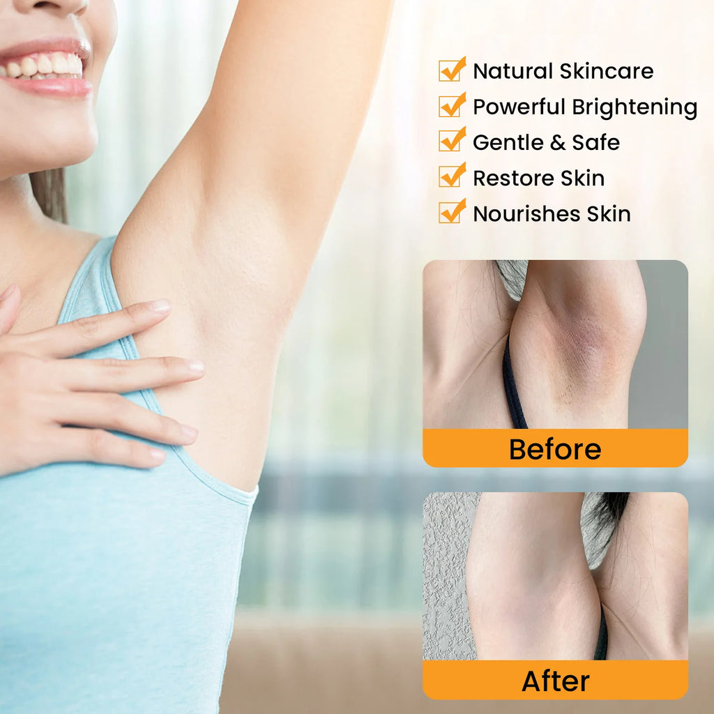 Whitening Cream For Dark Skin Underarm Bleaching Armpit Lightening And Intimate Area Woman Moisturizer Korean Skin Care Products Qme