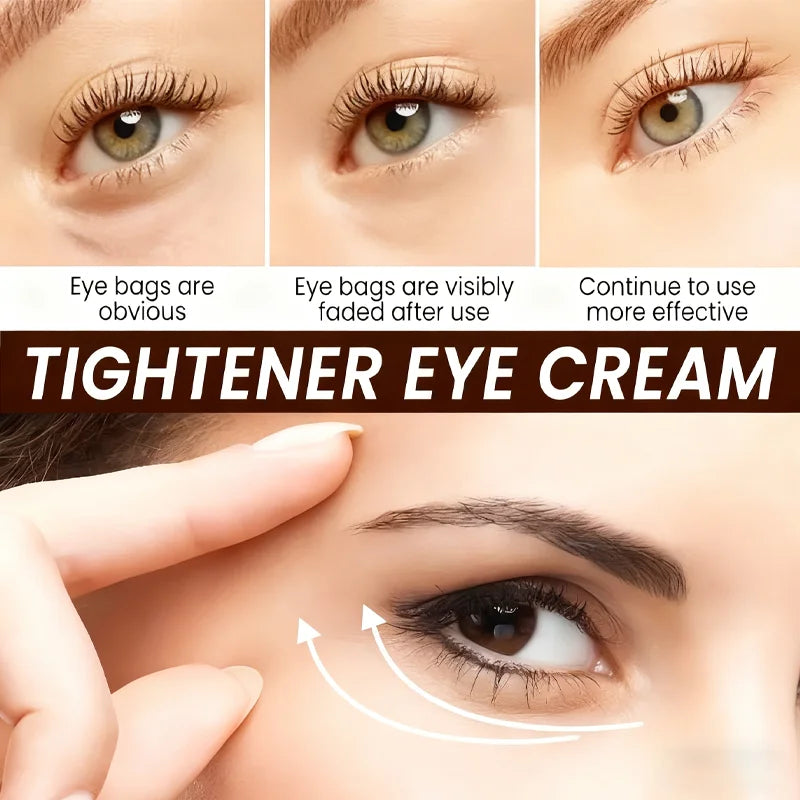 Botax Eye Cream 24H Lifting - Anti-Aging Formula with Vitamin C, Retinol & Bee Venom for Firm, Smooth & Youthful Skin. Qme