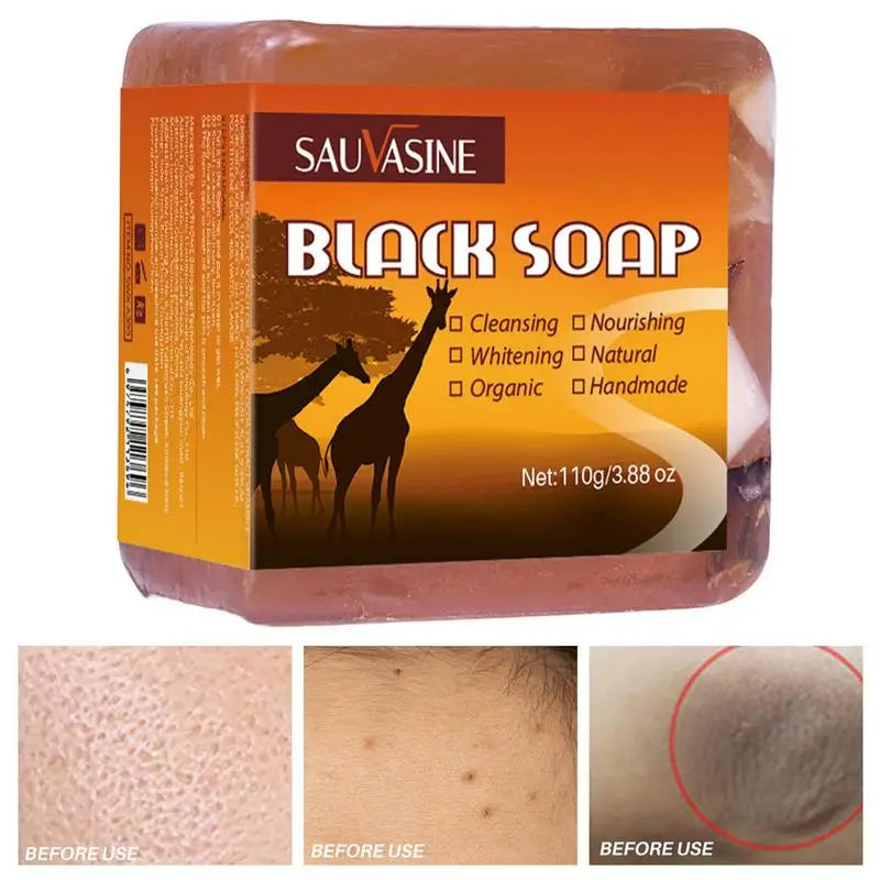 Dark Black Skin Cleansing Lightening Soap Organic Handmade African Qme