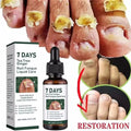 Fungal Nail Treatment Serum 7 Days Fungus Removal Treating Paronychia Liquid Anti Gray Nails Infection Foot Repair Care Tools Qme 1pc