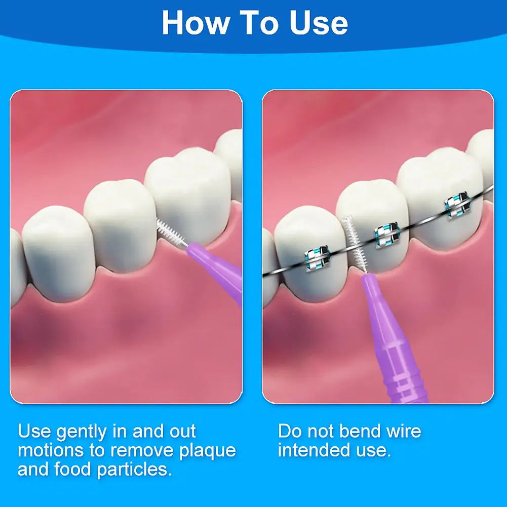 15 Pieces For Clean Tooth Brush Box Interdental Brush Gap Braces Gap Straight Orthodontic Interdental Brush Easy Use Qme