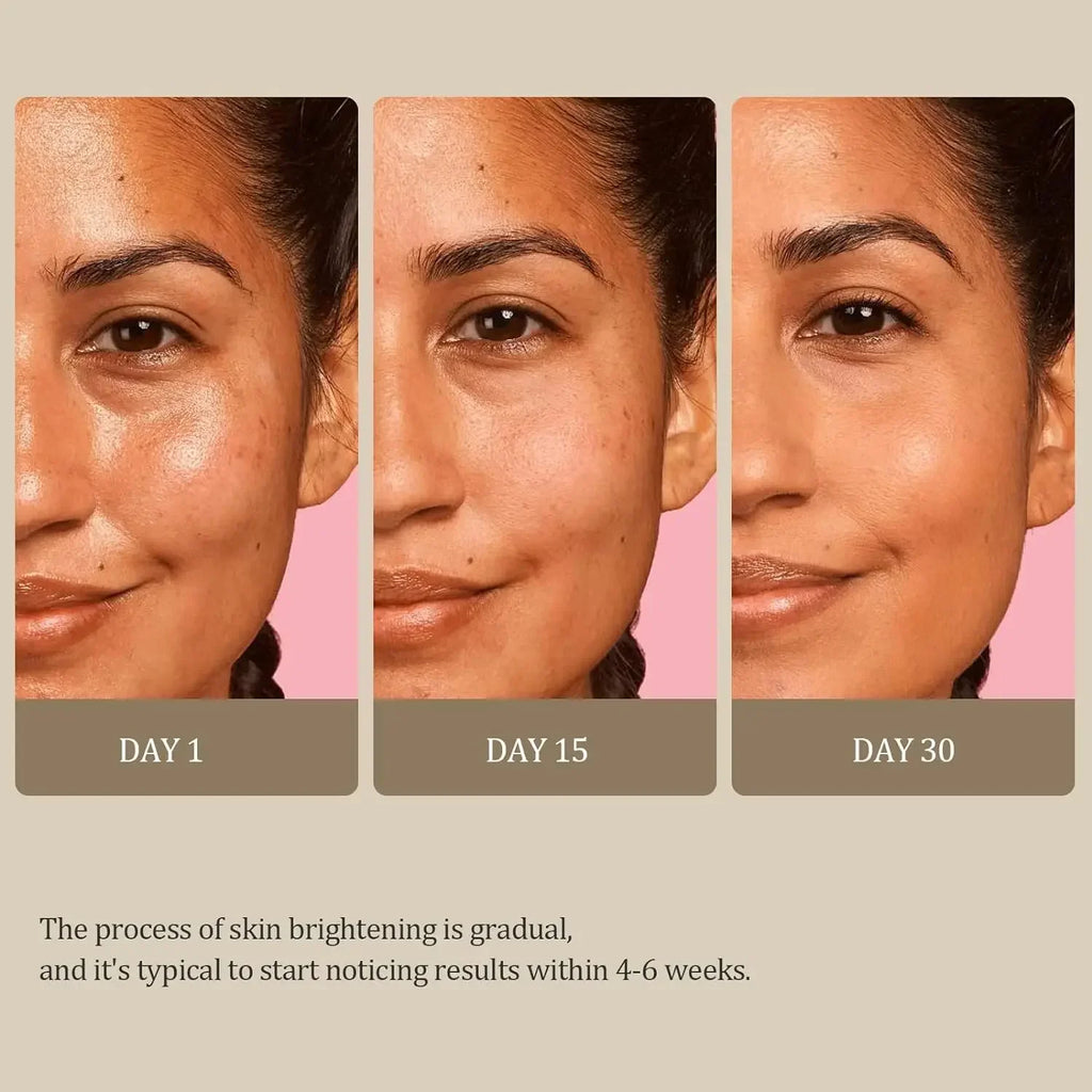 Turmeric Kojic Acid Glow Soap Dark Spot Acne Removal Even Skin Tone Mositen Smooth Skin Deep Cleansing Handmade Soap Qme