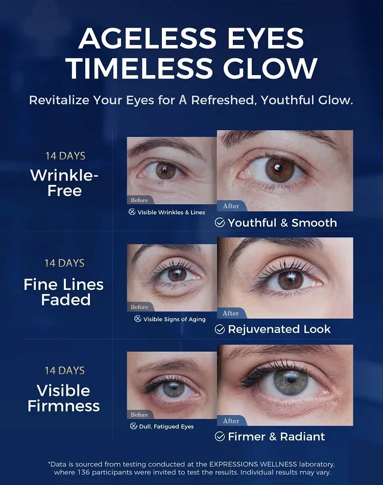 Expressions Wrinkle Eye Cream Anti-aging Retinol Serum Dark Circles Qme