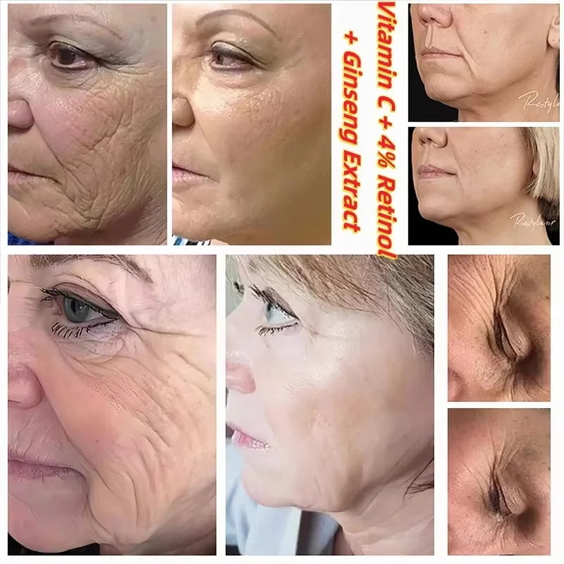 Seoul 1988 Retinol Ginseng Eye & Face Cream Serum Set Firming Moisturizing Diminish Lines Wrinkles Skin Care Essences Qme