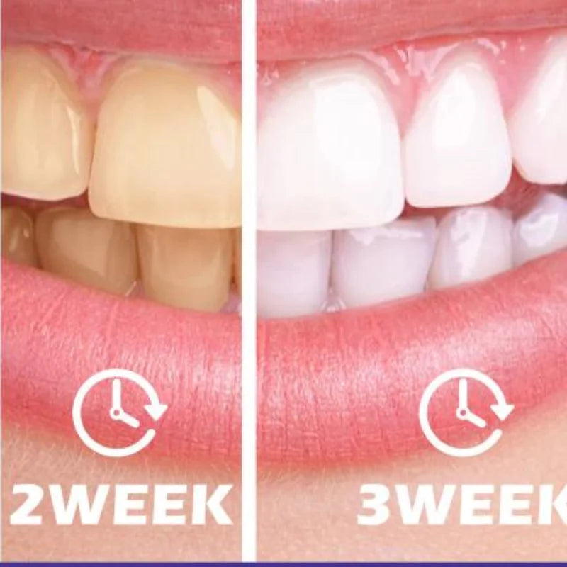 Advanced Purple Whitening Toothpaste Professional Stain Removal Odor Qme Default Title