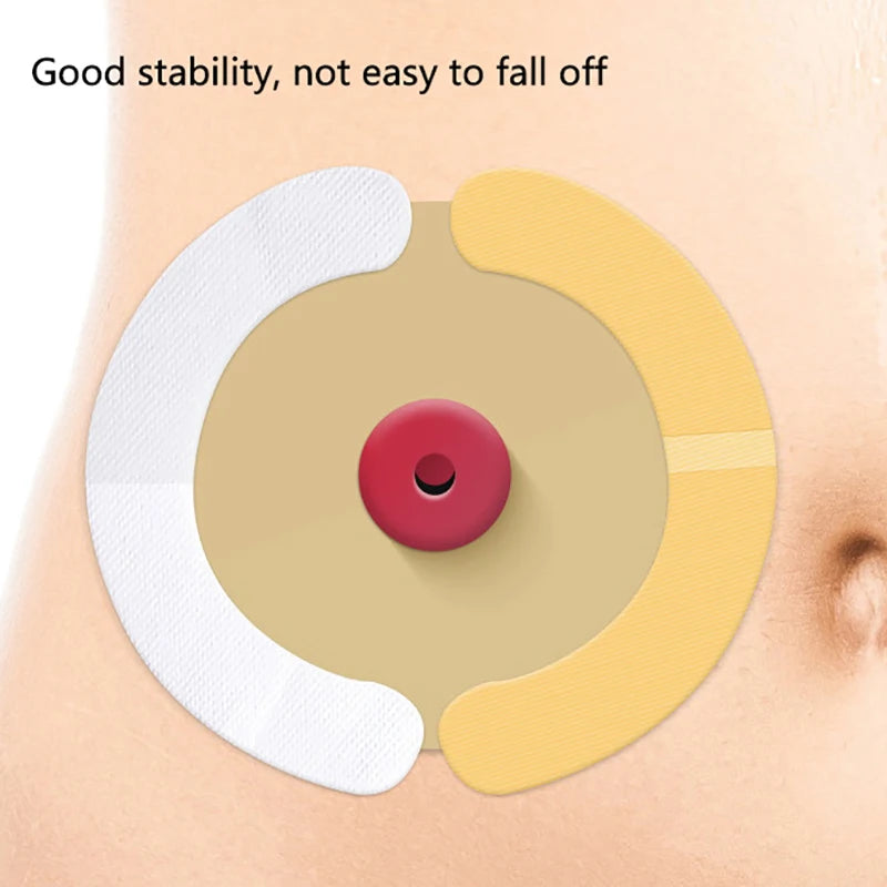 Box Hydrocolloid Elastic Ostomy Barrier Strips Waterproof Leak-proof Qme