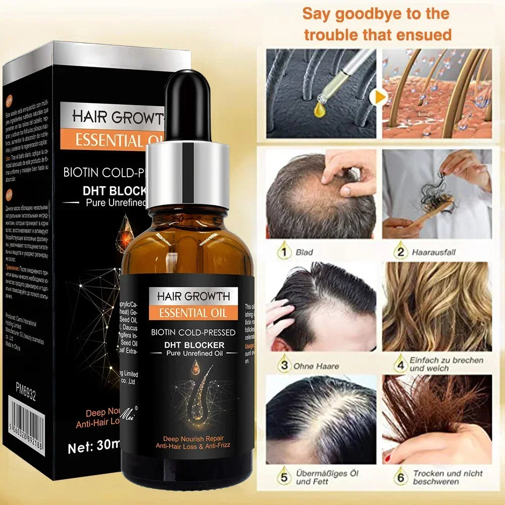 High Repurchase,Hair Growth Oil,Biotin DHT Blocker,Anti-Loss Shampoo,Boost Regrowth,Increase Production of Shampoo,hair Growth Qme